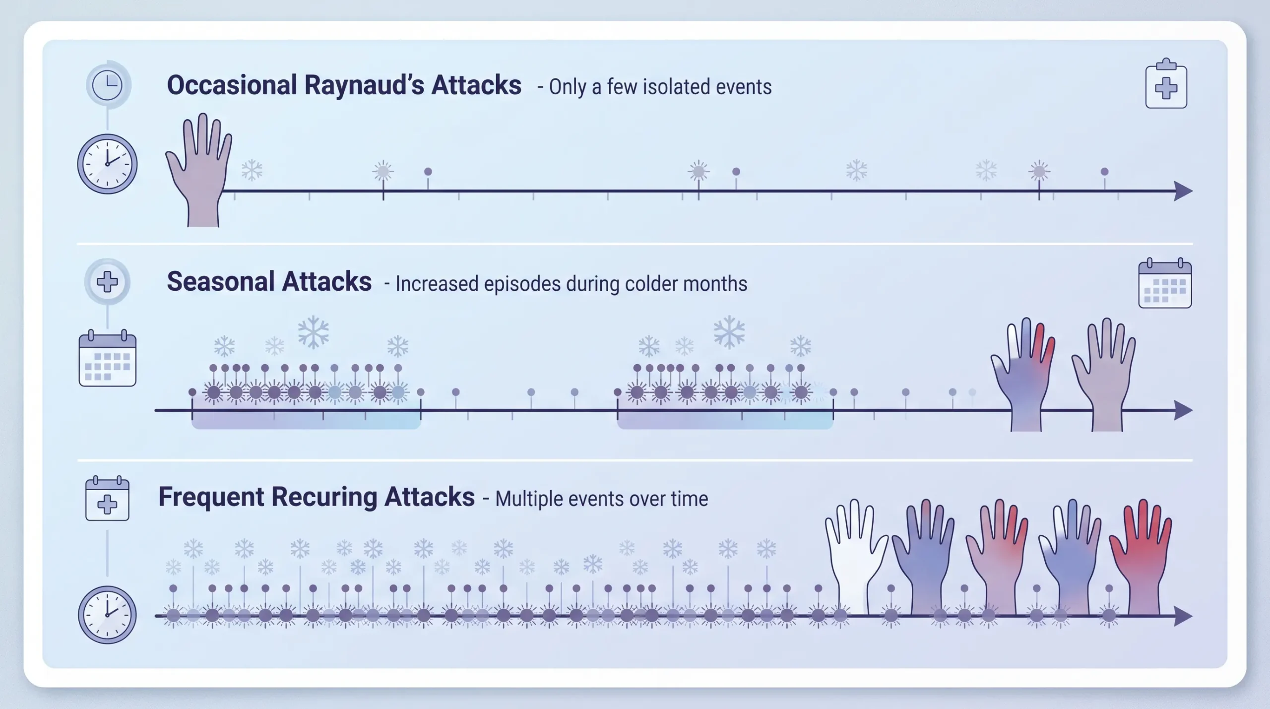 Raynaud’s Attack Frequency Patterns Different Raynaud’s attack frequency patterns showing occasional, seasonal, and frequent episodes